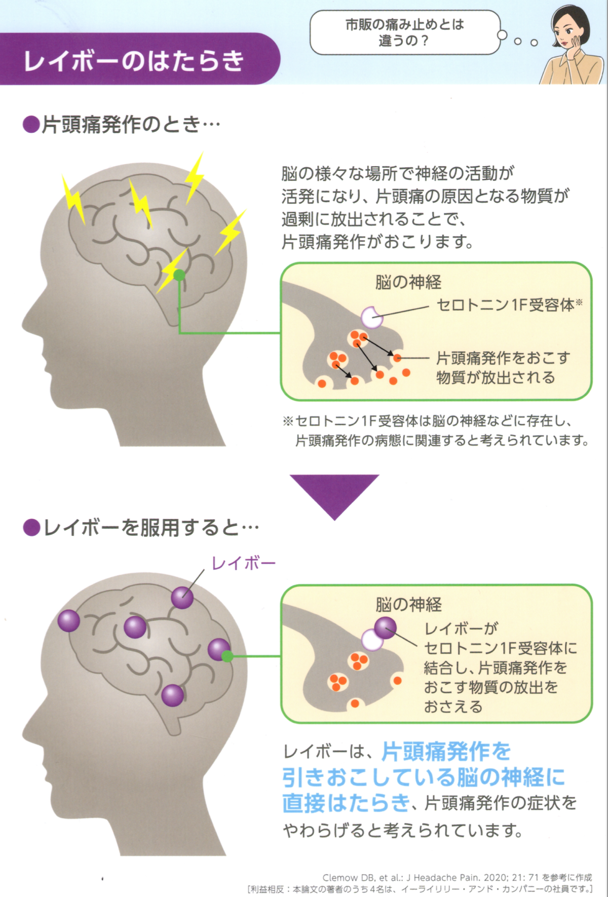 世界初「ジタン系」の片頭痛治療薬「レイボー」 | 春日駅前あべファミリークリニック内科 脳外科 整形外科【公式】文京区 後楽園駅1分